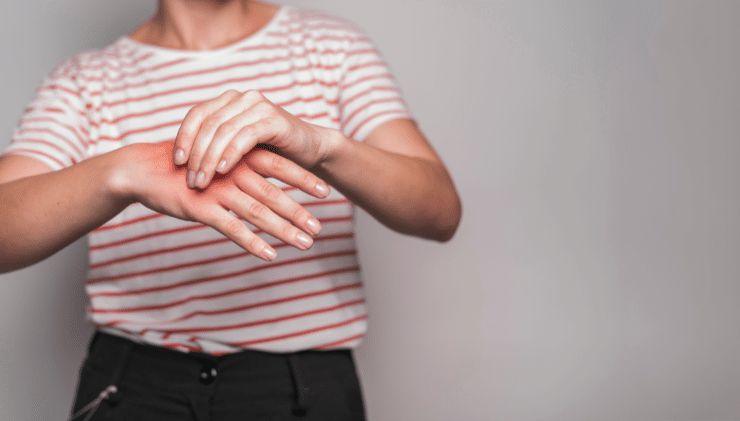 Herbs and Ayurvedic Remedies for Arthritis Pain